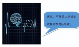 视频脑电图能检查出什么,揭示大脑活动的奥秘